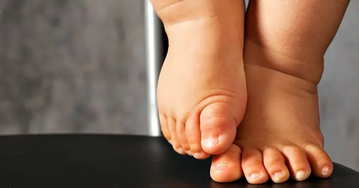 toddler foot peeling