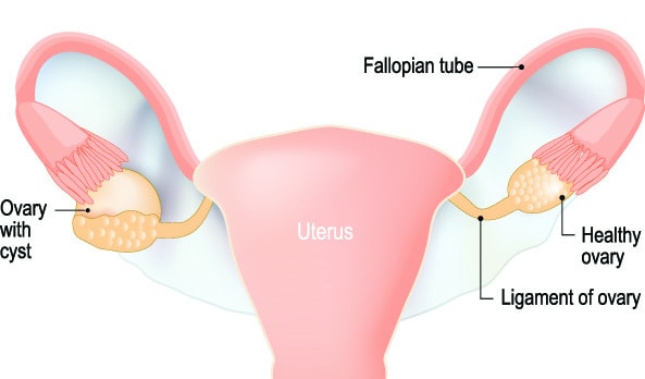 ovary-pain-early-pregnancy-sign